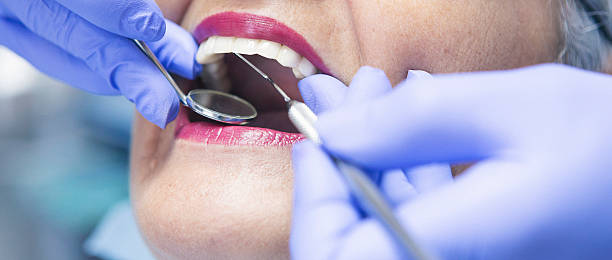 Best Emergency Dental Care for Broken or Chipped Teeth in Rathdrum, ID